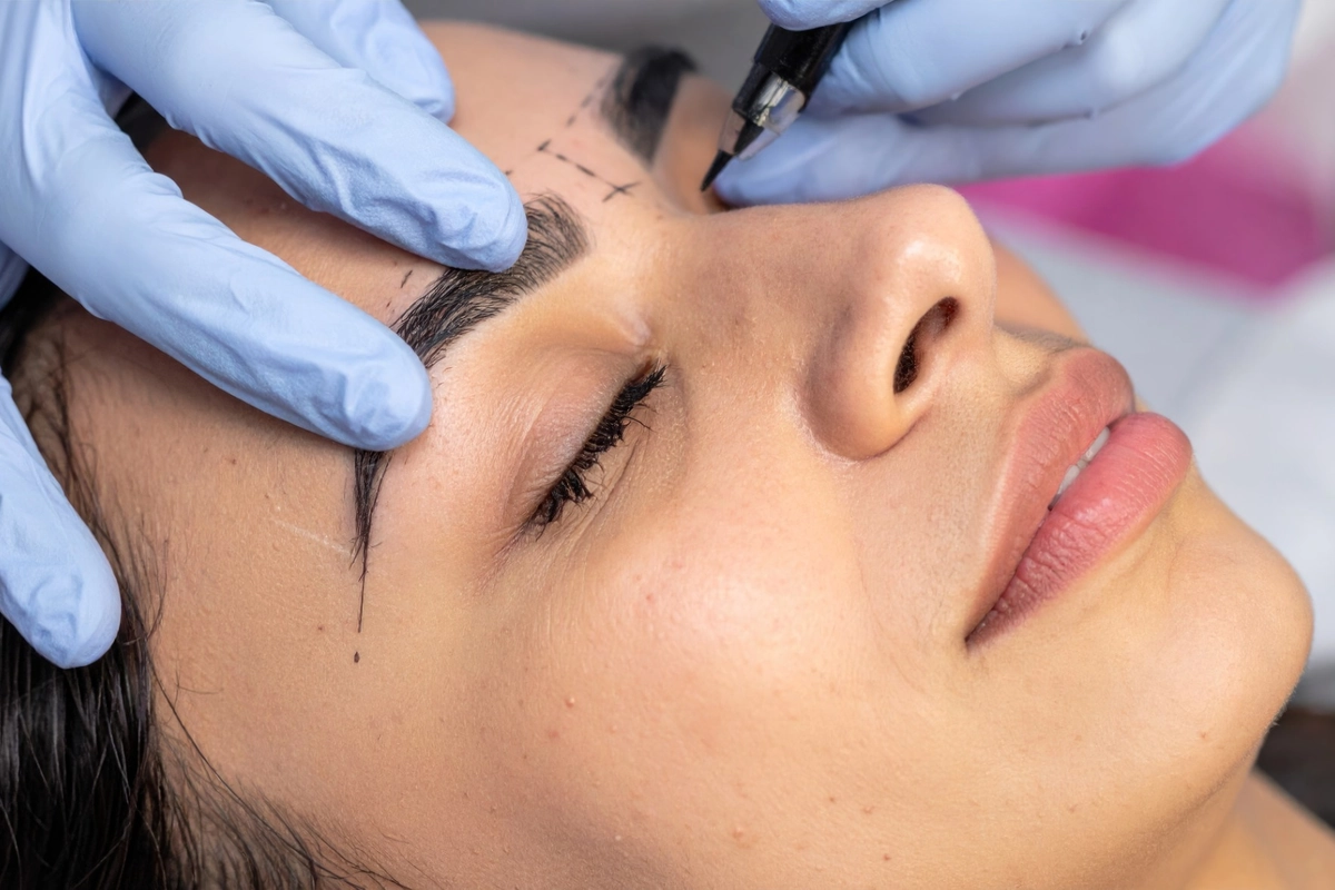 Patient receiving browlift treatment in ormond beach FL
